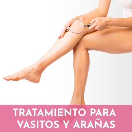 tratamiento-vasitos-vasculares